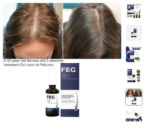 FEGPlus Minoxidil Beard & Hair Growth Serum